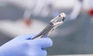 Tooth Extraction Huston - Willowbrook Dental Group