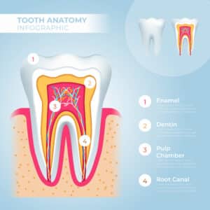 Root Canal in Houston TX